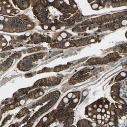 KCNJ15 Antibody, Novus Biologicals 25 &mu;L | Buy Online | Novus Biologicals | Fisher Scientific